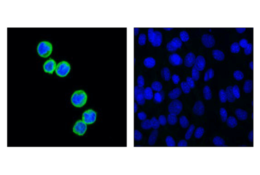  Image 32: β-Amyloid Mouse Model Neuronal Viability IF Antibody Sampler Kit