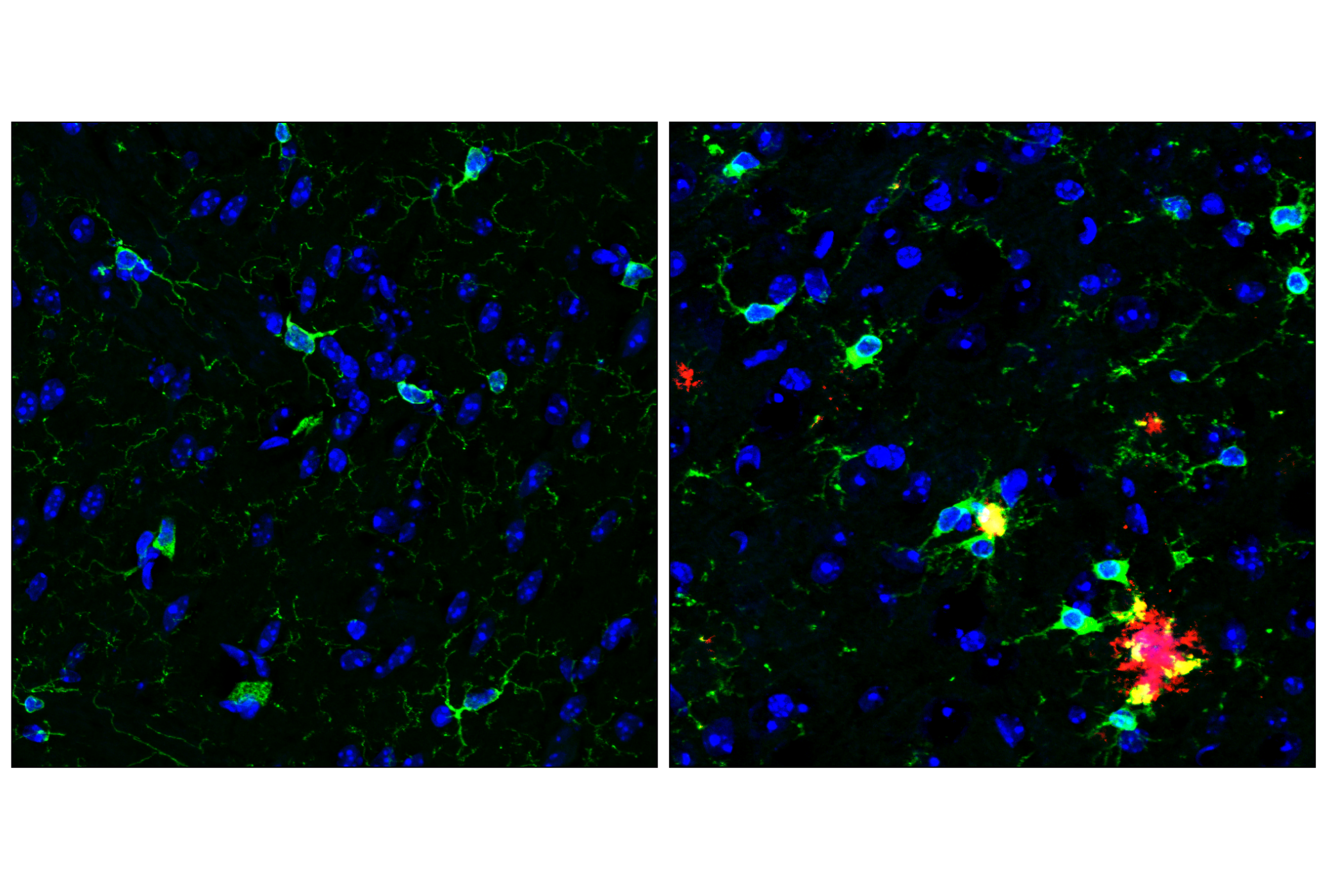  Image 31: β-Amyloid Mouse Model Neuronal Viability IF Antibody Sampler Kit