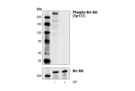 Western Blotting Image 1: Phospho-Bcr (Tyr177) Antibody