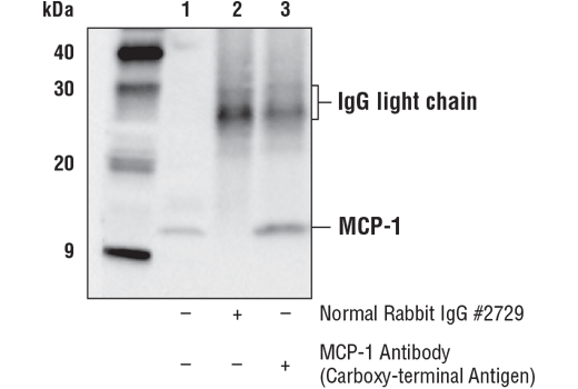 Immunoprecipitation Image 1: MCP-1 Antibody (Carboxy-terminal Antigen)