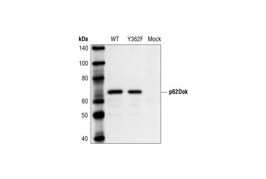 Western Blotting Image 1: p62Dok Antibody
