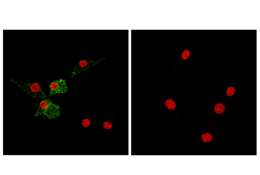 Immunofluorescence Image 2: CD11c (D1V9Y) Rabbit mAb (BSA and Azide Free)