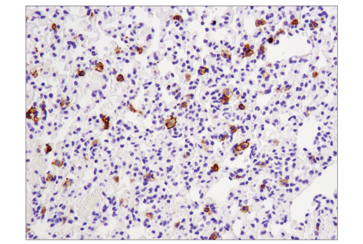 Immunohistochemistry Image 5: CD11c (D1V9Y) Rabbit mAb (BSA and Azide Free)