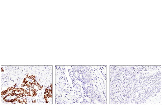 Immunohistochemistry Image 1: SATB2 (E8R8H) Rabbit mAb