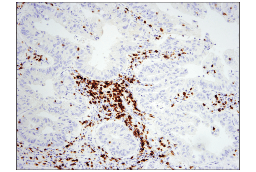 Immunohistochemistry Image 1: CD5 (E8X3S) XP® Rabbit mAb