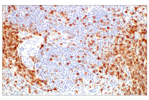 Immunohistochemistry Image 7: CD5 (E8X3S) XP® Rabbit mAb