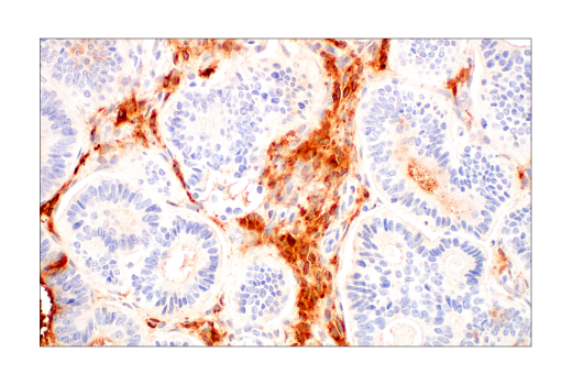 Immunohistochemistry Image 5: ApoE4 (E5M4L) Rabbit mAb