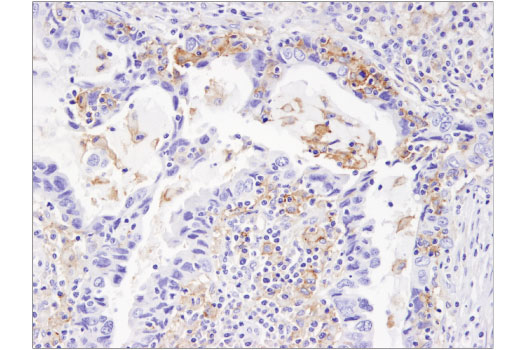 Immunohistochemistry Image 4: PD-L1 (405.9A11) Mouse mAb (BSA and Azide Free)