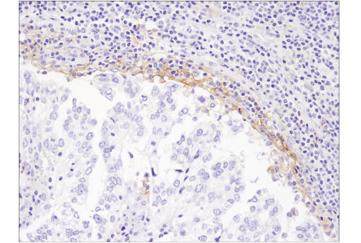 Immunohistochemistry Image 5: PD-L1 (405.9A11) Mouse mAb (BSA and Azide Free)