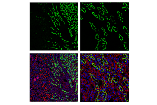 Immunofluorescence Image 2: AQP4 (D1F8E) XP® Rabbit mAb (BSA and Azide Free)