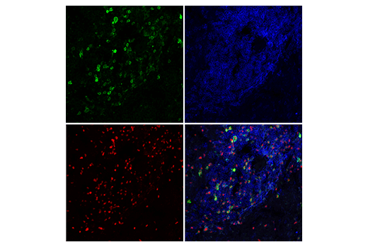 Immunofluorescence Image 1: IL-2Rα/CD25 (E9W2J) XP® Rabbit mAb