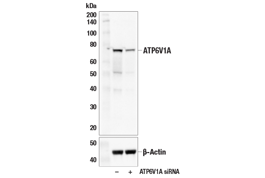Western Blotting Image 2: ATP6V1A (E5N9E) Rabbit mAb