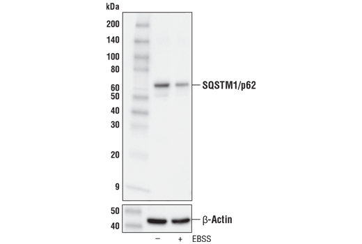  Image 15: p62/KEAP1/NRF2 Pathway Antibody Sampler Kit