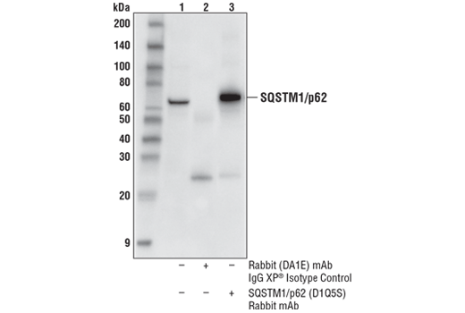 Immunoprecipitation Image 1: SQSTM1/p62 (D1Q5S) Rabbit mAb