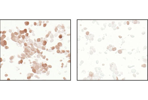 Immunohistochemistry Image 4: Phospho-4E-BP1 (Thr37/46) (236B4) Rabbit mAb (BSA and Azide Free)