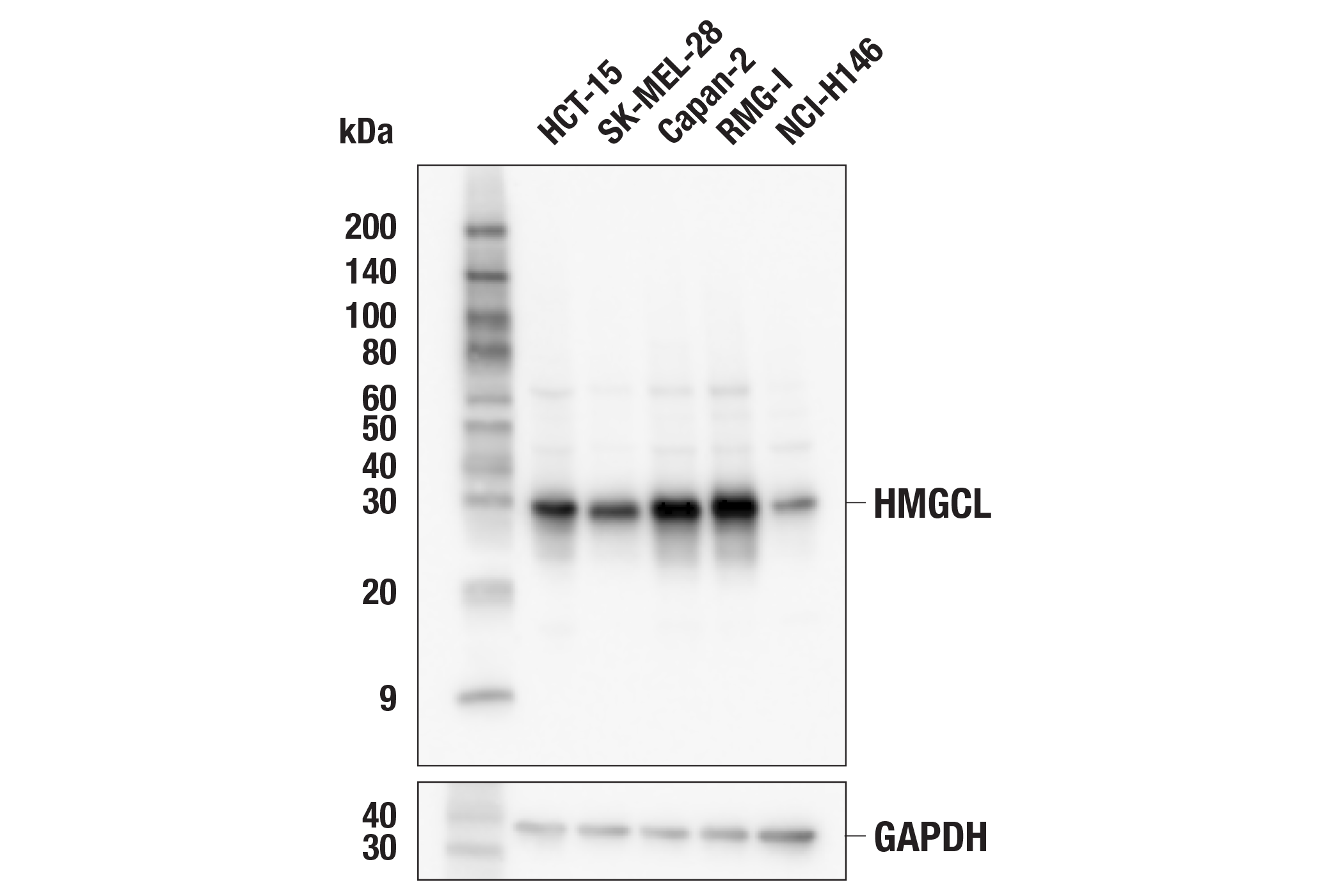 Western Blotting Image 1: HMGCL (E5H7V) Rabbit mAb