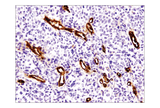 Immunohistochemistry Image 1: CD36 (D8L9T) Rabbit mAb (BSA and Azide Free)