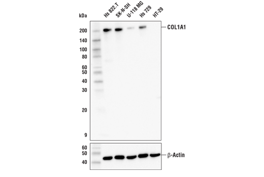  Image 9: ECM Profiling Antibody Sampler Kit