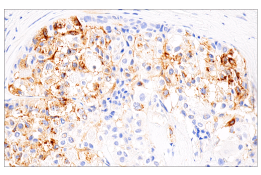 Immunohistochemistry Image 2: AFP (C3) Mouse mAb