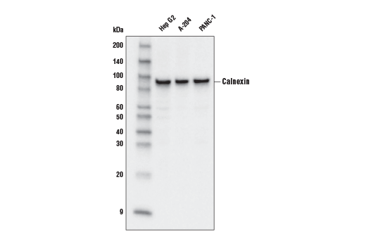 Western Blotting Image 1: Calnexin (C5C9) Rabbit mAb (HRP Conjugate)