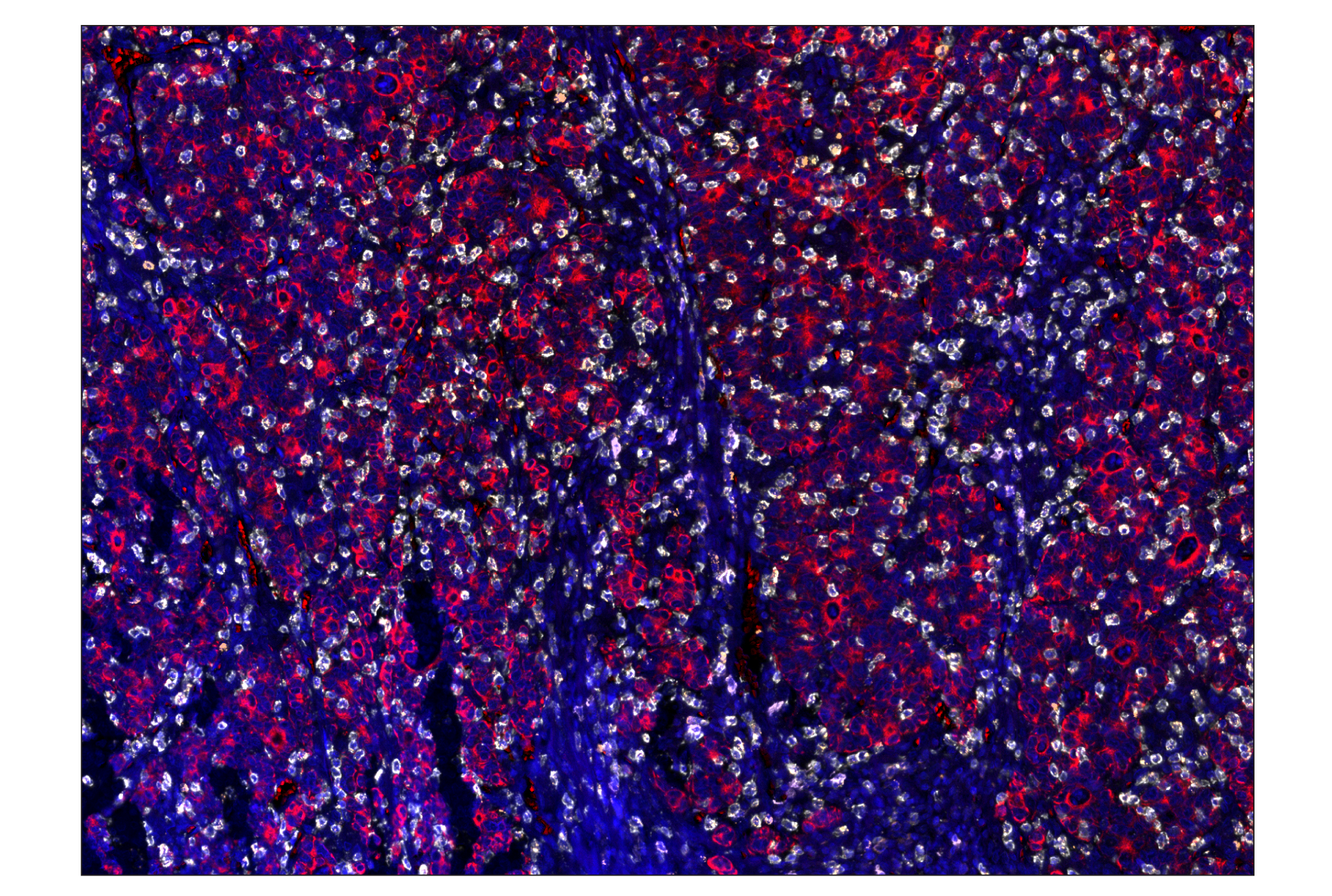 Immunohistochemistry Image 7: CD20 (E7B7T) & CO-0011-647 SignalStar™ Oligo-Antibody Pair