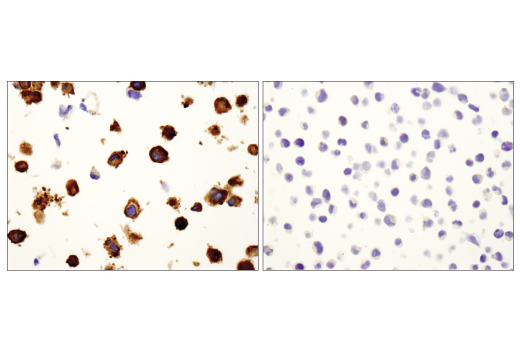 Immunohistochemistry Image 6: Vinculin (E1E9V) XP® Rabbit mAb (BSA and Azide Free)