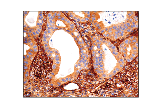 Immunohistochemistry Image 1: Vinculin (E1E9V) XP® Rabbit mAb (BSA and Azide Free)