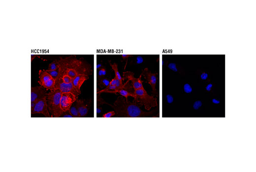 Immunofluorescence Image 1: PD-L1 (Extracellular Domain Specific) (D8T4X) Rabbit mAb (Alexa Fluor® 555 Conjugate)