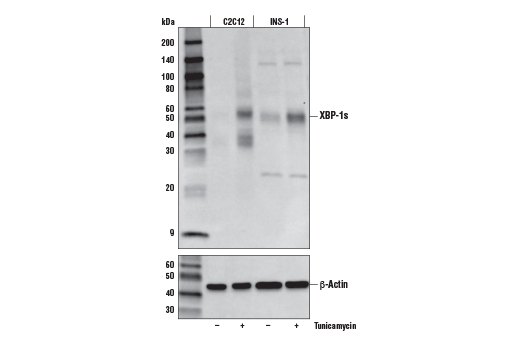  Image 21: ER Homeostasis Antibody Sampler Kit
