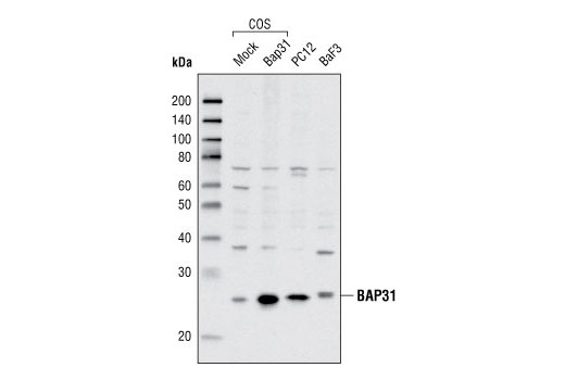 Western Blotting Image 1: BAP31 Antibody