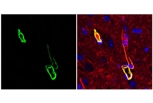 Immunofluorescence Image 1: Transgelin/TAGLN Antibody