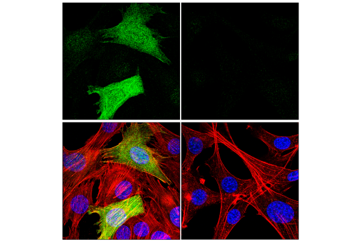Immunofluorescence Image 4: Transgelin/TAGLN Antibody