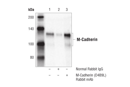 Immunoprecipitation Image 1: M-Cadherin (D4B9L) Rabbit mAb
