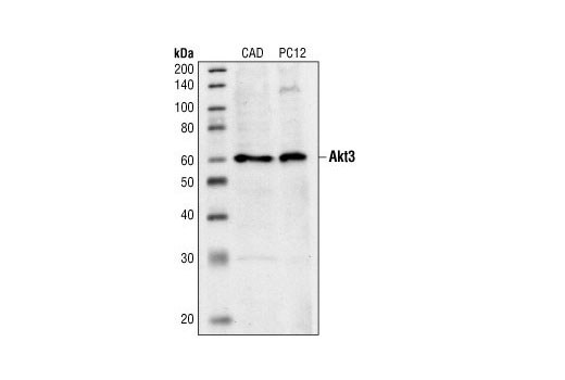 Western Blotting Image 1: Akt3 Antibody