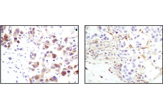  Image 22: Microglia Interferon-Related Module Antibody Sampler Kit