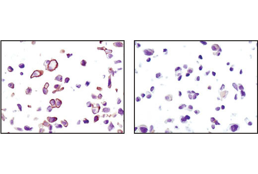  Image 26: Phospho-Akt Isoform Antibody Sampler Kit