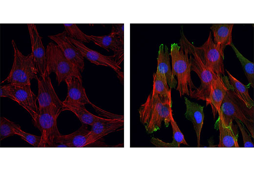  Image 45: Microglia Interferon-Related Module Antibody Sampler Kit