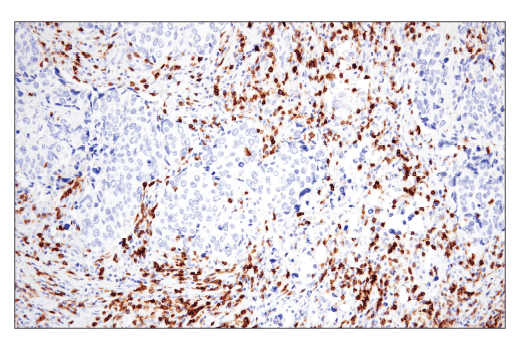 Immunohistochemistry Image 4: CD6 (E9Y7Y) Rabbit mAb