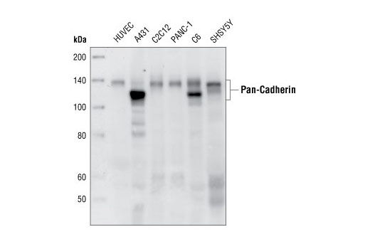  Image 8: Cadherin-Catenin Antibody Sampler Kit