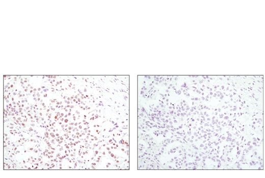 Immunohistochemistry Image 1: Phospho-ATF-2 (Thr69/71)/ATF-7 (Thr51/53) Antibody