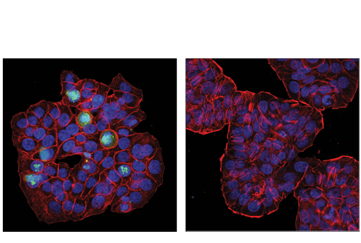 Immunofluorescence Image 1: Phospho-CASC5 (Thr943/Thr1155) (D8D4N) Rabbit mAb