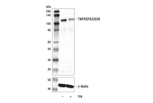 Western Blotting Image 3: TNFRSF8/CD30 Antibody