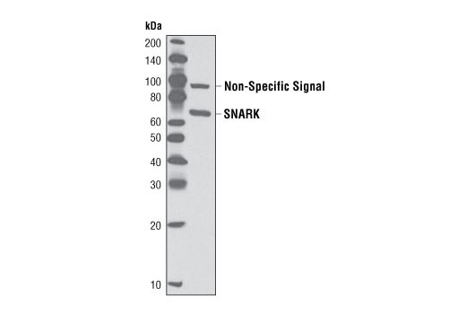 Western Blotting Image 1: SNARK/NUAK2 Antibody