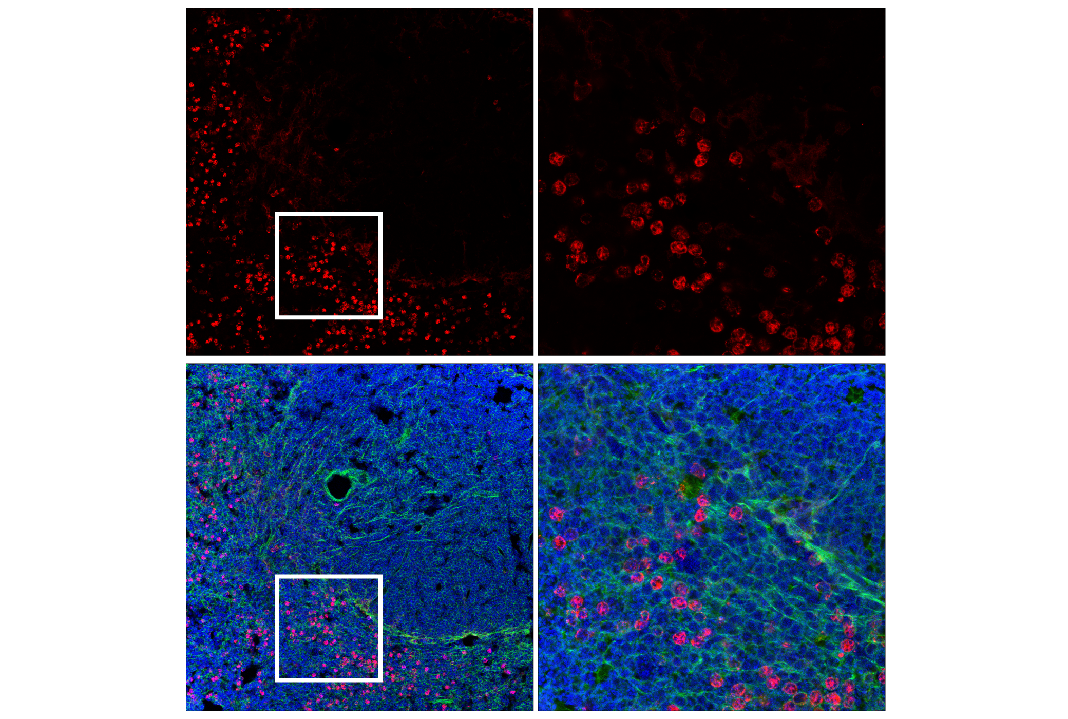 Immunofluorescence Image 2: CD11b/ITGAM (E6E1M) Rabbit mAb (BSA and Azide Free)