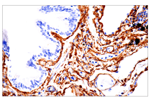Immunohistochemistry Image 3: TMEM119 (E3E4T) Mouse mAb