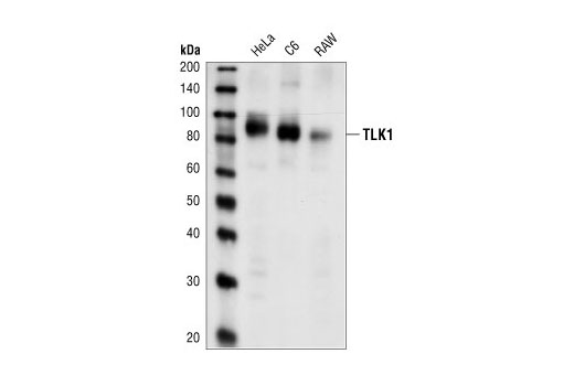 Western Blotting Image 1: TLK1 Antibody