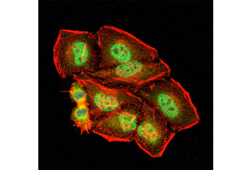Immunofluorescence Image 1: TLK1 Antibody