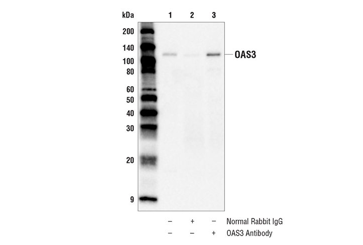 Immunoprecipitation Image 1: OAS3 Antibody