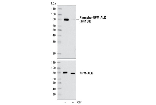 Western Blotting Image 1: Phospho-ALK (Tyr1078) Antibody