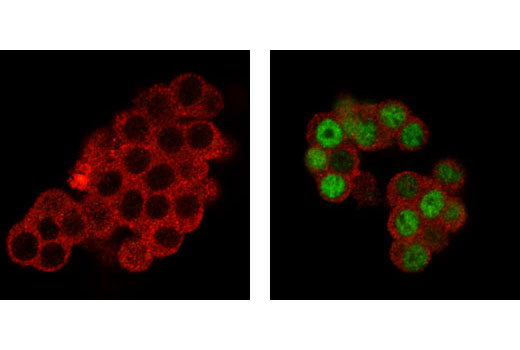 Immunofluorescence Image 1: EGR1 (44D5) Rabbit mAb